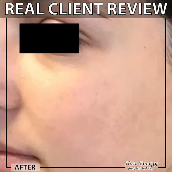 🌟 0.5mm Derma Glow Roller – Smooth, Tighten, Shine!