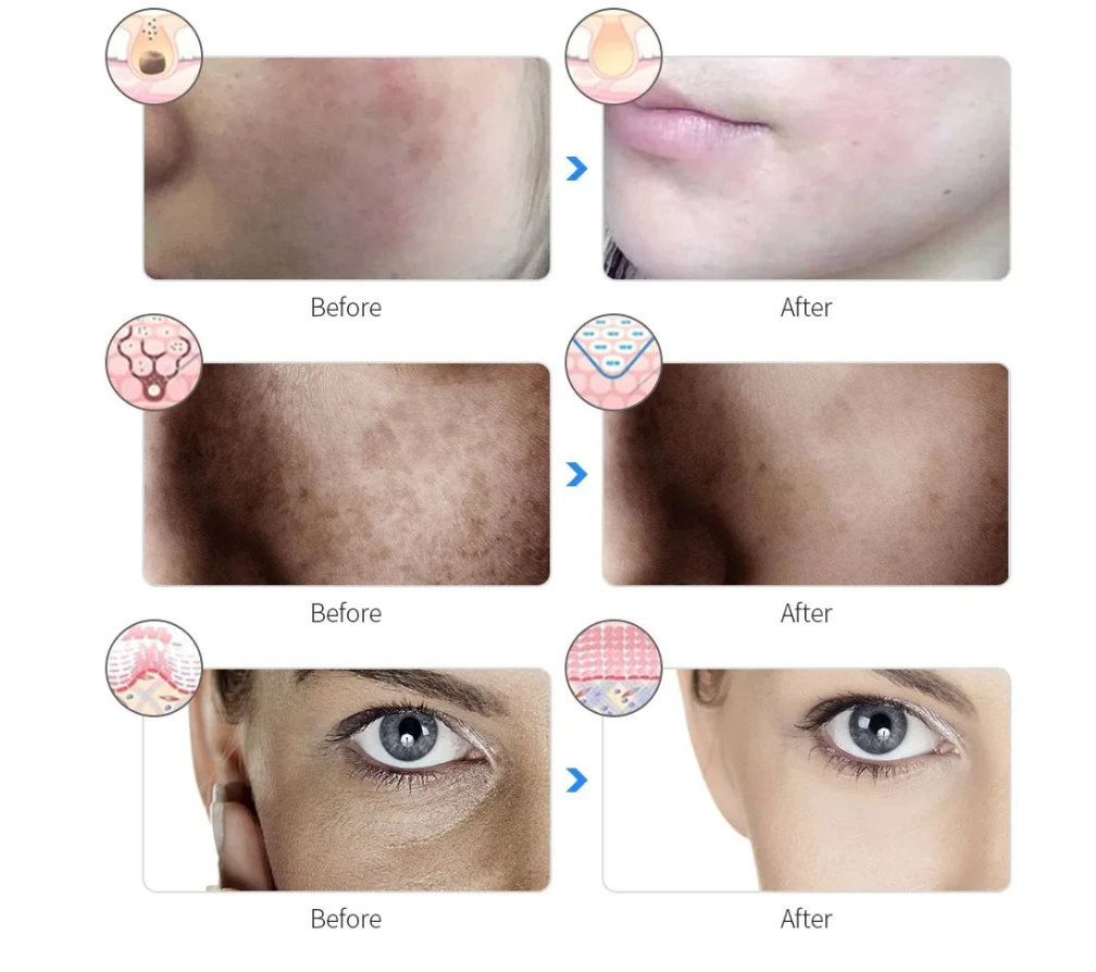 🌈 LED Therapy Mask – Salon Glow at Home