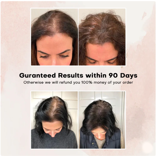 Red Light Therapy Hair Brush – For Stronger, Fuller Hair 🔴💪